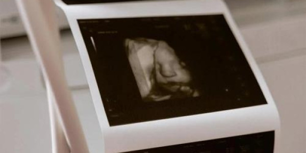 Tribunal permite aborto de bebê de 35 semanas por ser deficiente